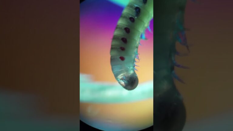 Los peligros de los bichos debajo de las uñas