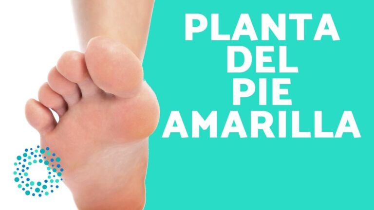 Causas y Soluciones para la Planta del Pie Amarilla