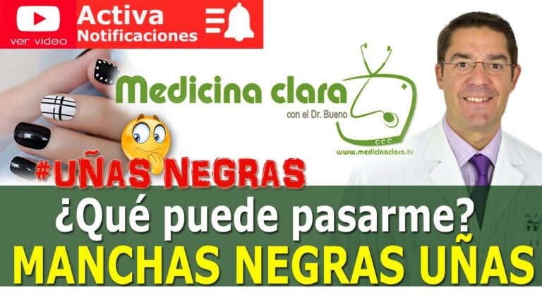 Cómo eliminar las manchas marrones en las uñas de las manos