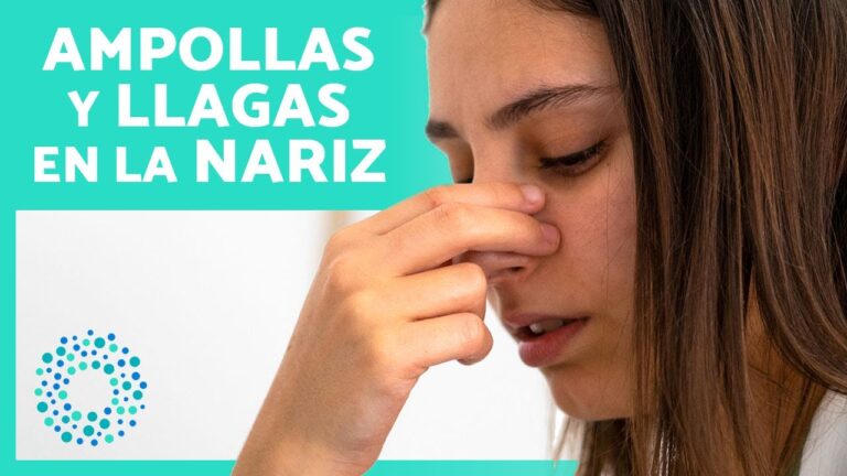Remedios Caseros Efectivos para Heridas Nasales