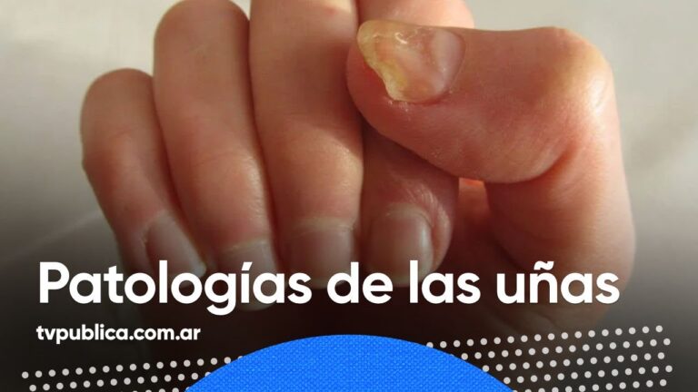 U&ntilde;as Marrones: Signos de Enfermedad y Cuidados Esenciales