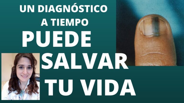 Rayas Negras en las U&ntilde;as: Causas y Soluciones para Hongos